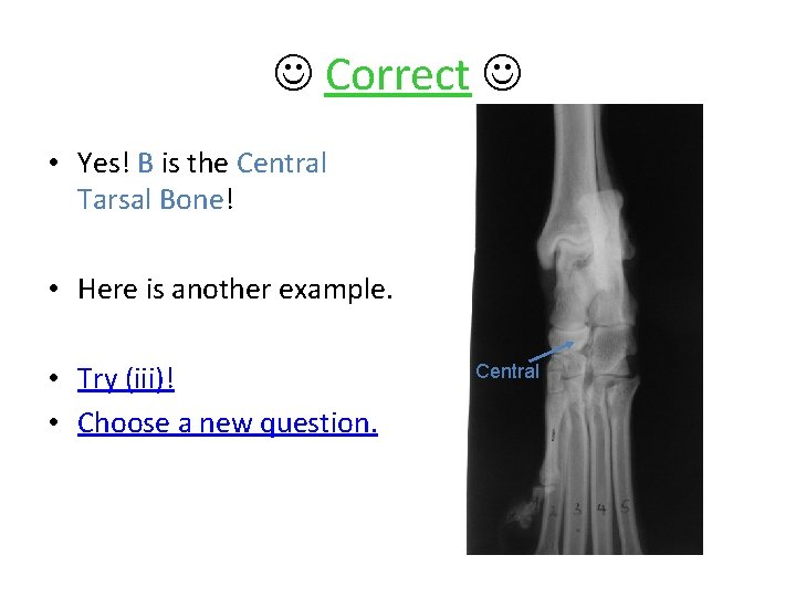  Correct • Yes! B is the Central Tarsal Bone! • Here is another