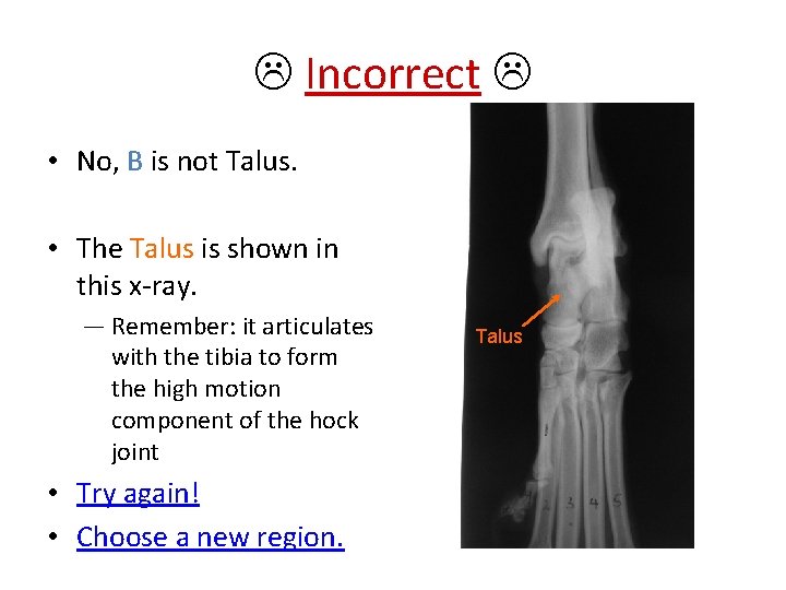  Incorrect • No, B is not Talus. • The Talus is shown in