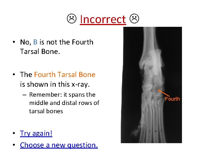  Incorrect • No, B is not the Fourth Tarsal Bone. • The Fourth