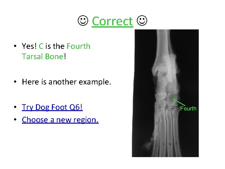  Correct • Yes! C is the Fourth Tarsal Bone! • Here is another