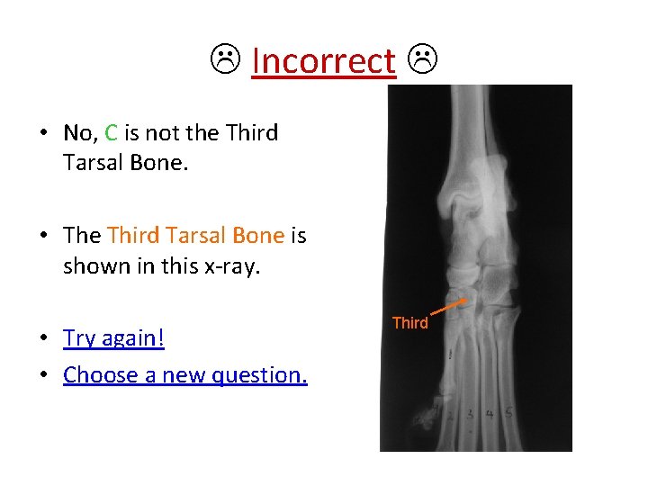  Incorrect • No, C is not the Third Tarsal Bone. • The Third