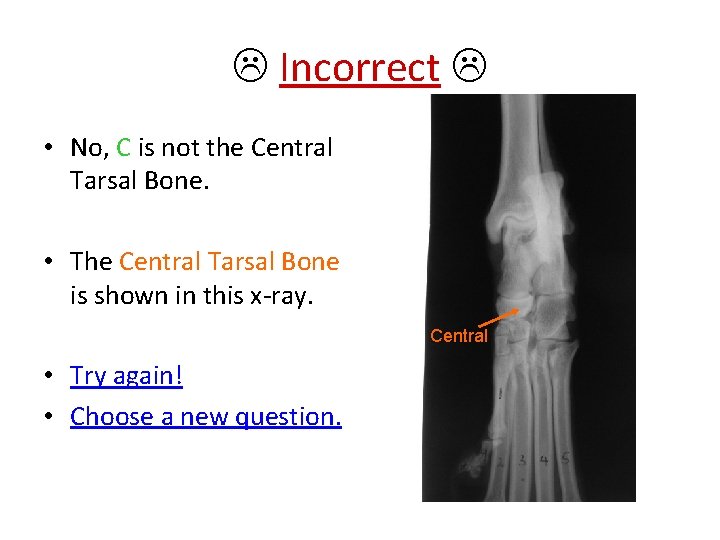  Incorrect • No, C is not the Central Tarsal Bone. • The Central