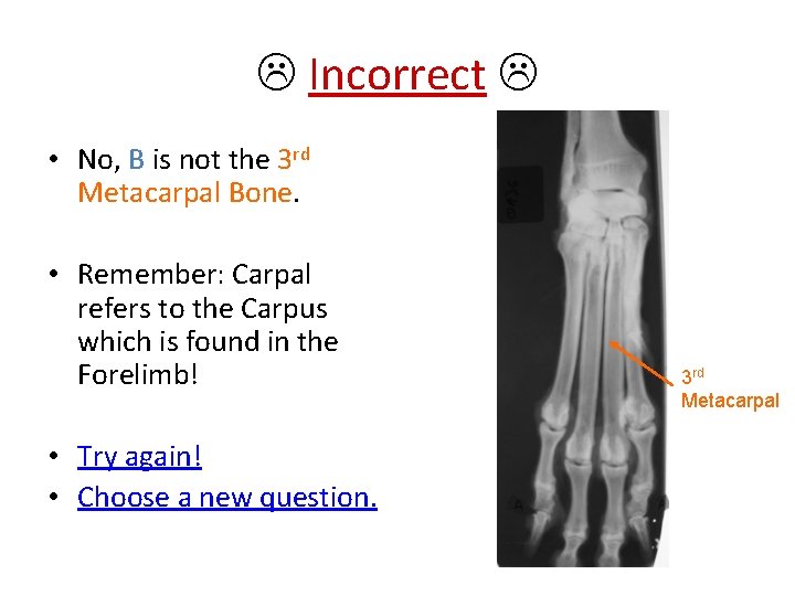  Incorrect • No, B is not the 3 rd Metacarpal Bone. • Remember: