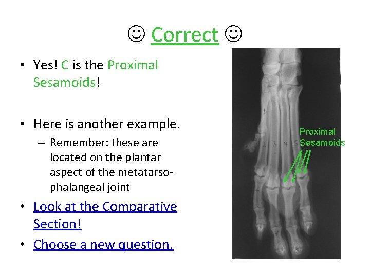  Correct • Yes! C is the Proximal Sesamoids! • Here is another example.