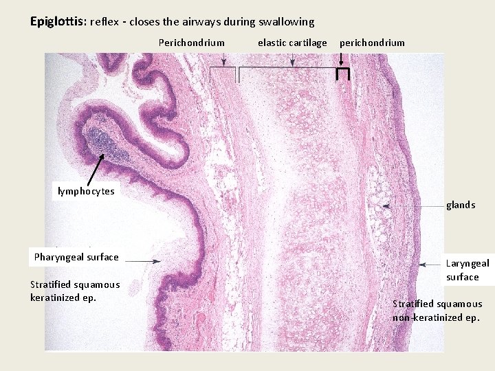 Epiglottis: reflex - closes the airways during swallowing Perichondrium elastic cartilage perichondrium lymphocytes glands