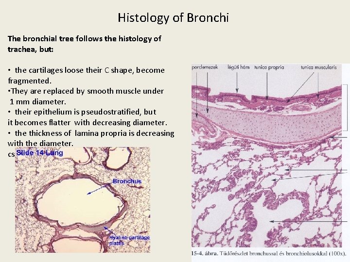Histology of Bronchi The bronchial tree follows the histology of trachea, but: • the