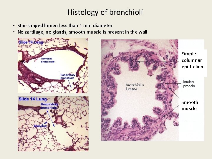 Histology of bronchioli • Star-shaped lumen less than 1 mm diameter • No cartilage,