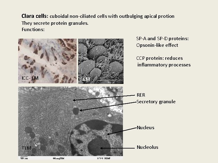Clara cells: cuboidal non-ciliated cells with outbulging apical protion They secrete protein granules. Functions:
