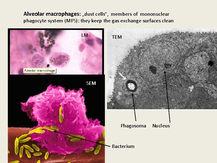 Alveolar macrophages: „dust cells”, members of mononuclear phagocyte system (MPS): they keep the gas
