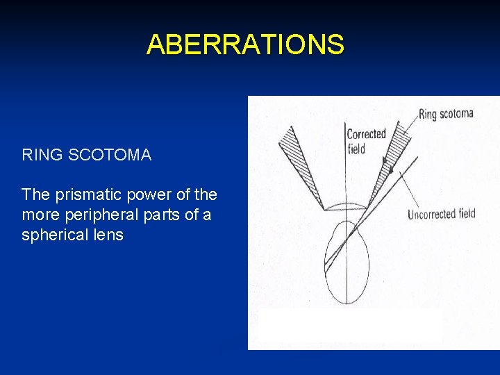 ABERRATIONS RING SCOTOMA The prismatic power of the more peripheral parts of a spherical