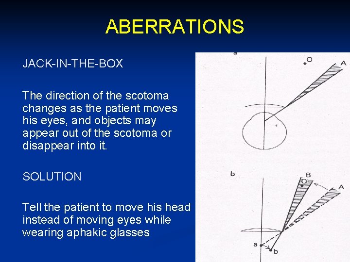 ABERRATIONS JACK-IN-THE-BOX The direction of the scotoma changes as the patient moves his eyes,