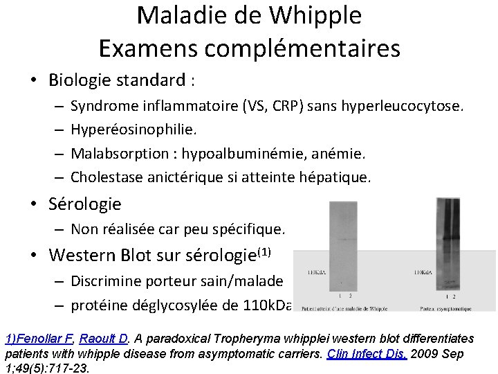 Maladie de Whipple Examens complémentaires • Biologie standard : – – Syndrome inflammatoire (VS,