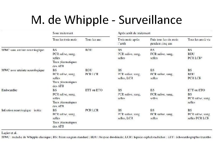 M. de Whipple - Surveillance 