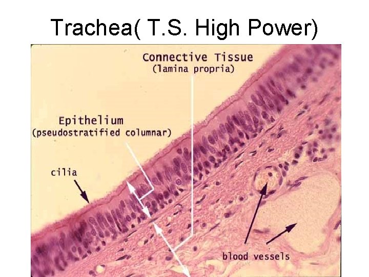 Trachea( T. S. High Power) Trachea( T. S. High Power)