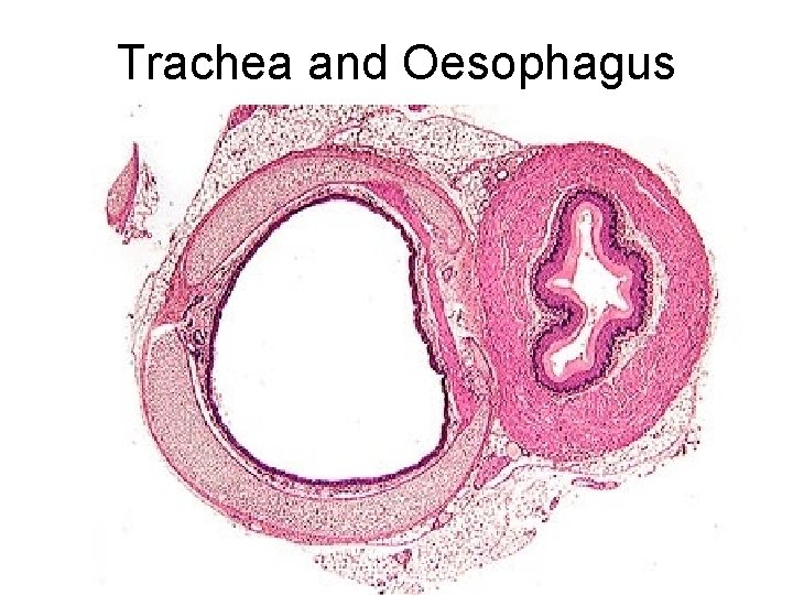 Trachea and Oesophagus Trachea and Oesophagus