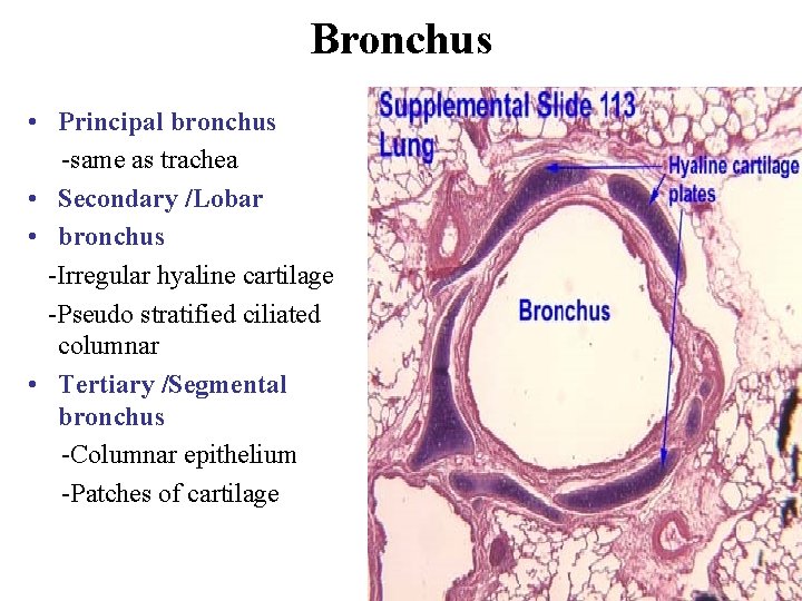 Bronchus • Principal bronchus -same as trachea • Secondary /Lobar • bronchus -Irregular hyaline Bronchus • Principal bronchus -same as trachea • Secondary /Lobar • bronchus -Irregular hyaline