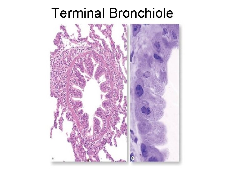 Terminal Bronchiole Terminal Bronchiole