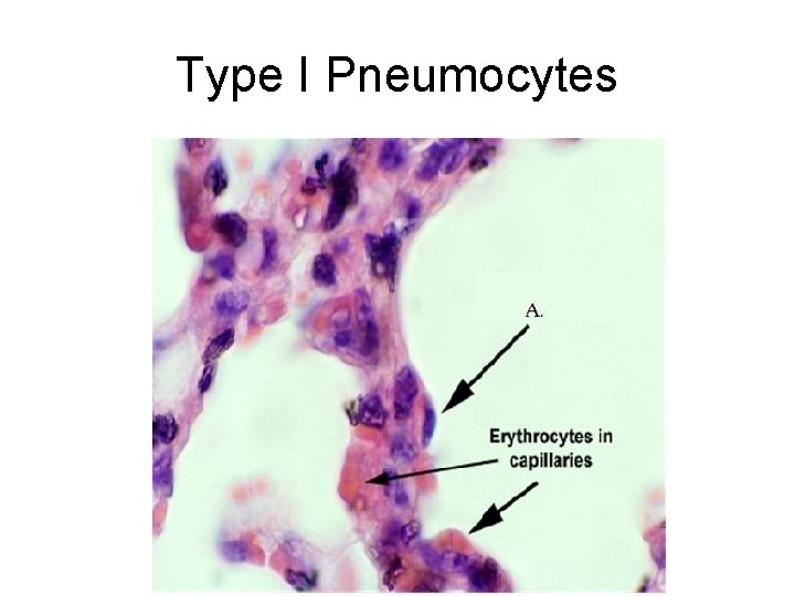 Type I Pneumocytes Type I Pneumocytes