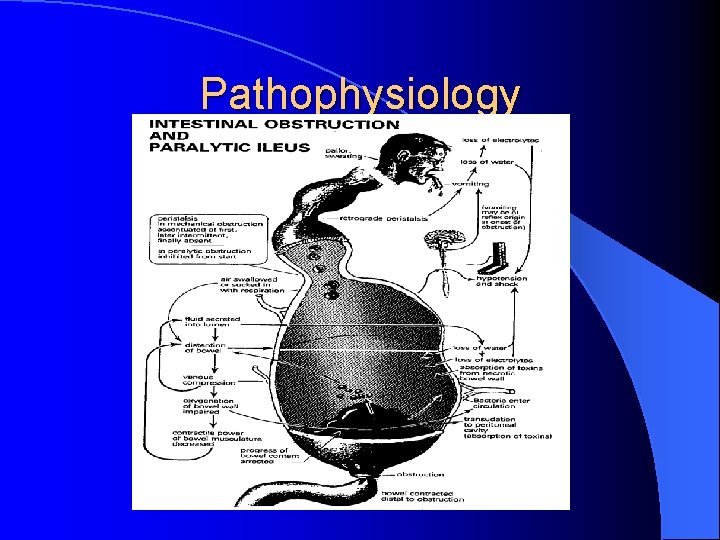 Pathophysiology 