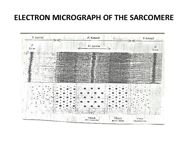 ELECTRON MICROGRAPH OF THE SARCOMERE 
