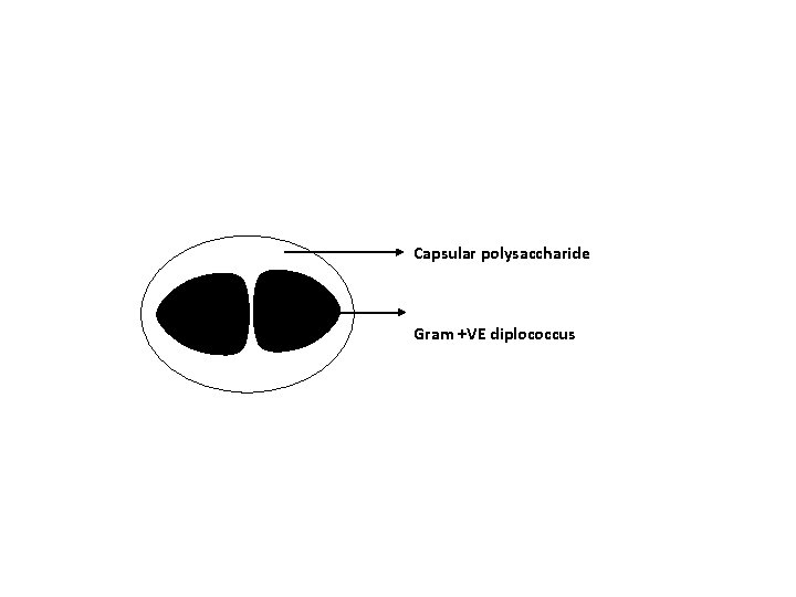 Capsular polysaccharide Gram +VE diplococcus 