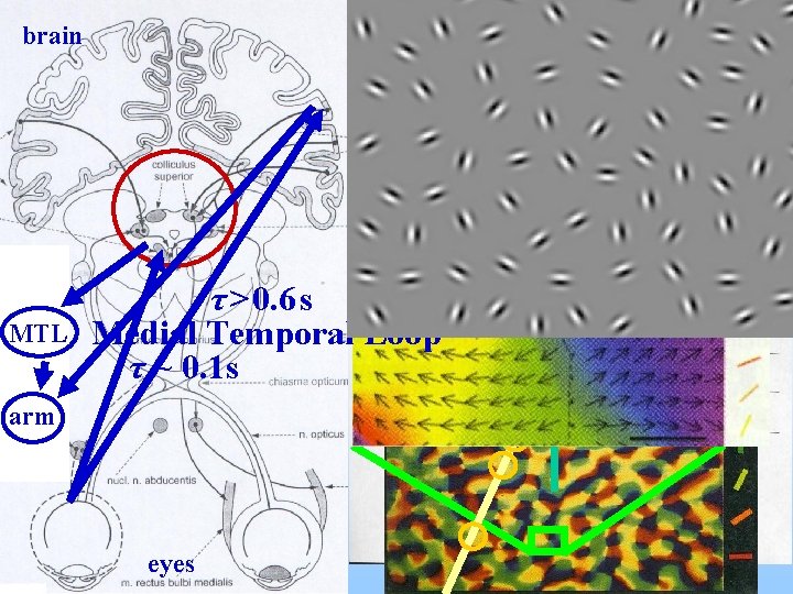 brain Colliculus superior MTL τ > 0. 6 s Medial Temporal Loop τ ~
