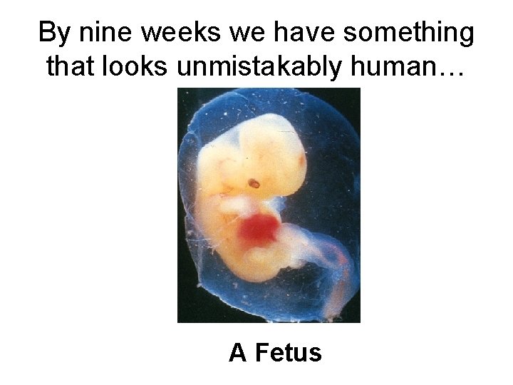 By nine weeks we have something that looks unmistakably human… A Fetus 