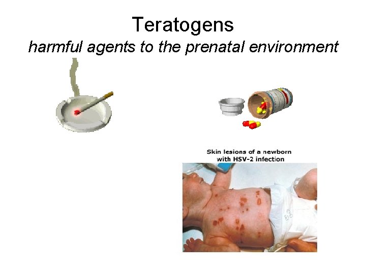 Teratogens harmful agents to the prenatal environment 
