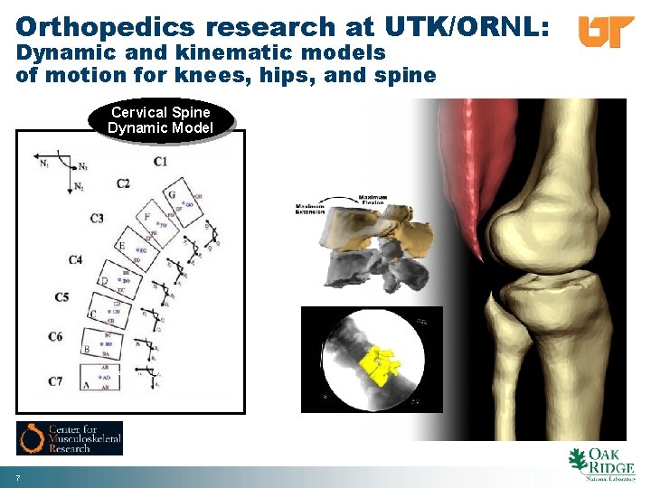 Orthopedics research at UTK/ORNL: Dynamic and kinematic models of motion for knees, hips, and