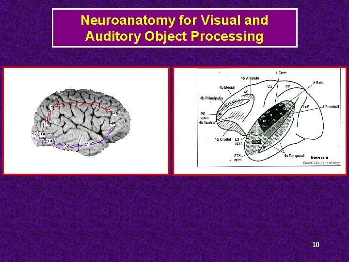 Neuroanatomy for Visual and Auditory Object Processing Kass et al. 10 