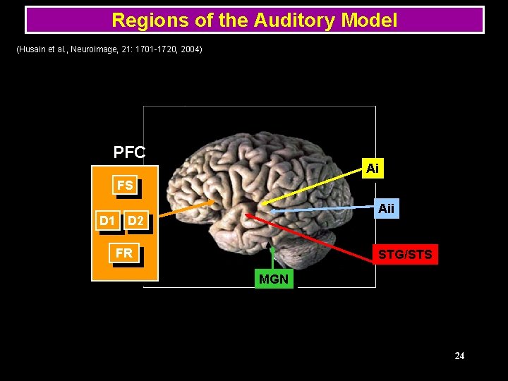 Regions of the Auditory Model (Husain et al. , Neuroimage, 21: 1701 -1720, 2004)