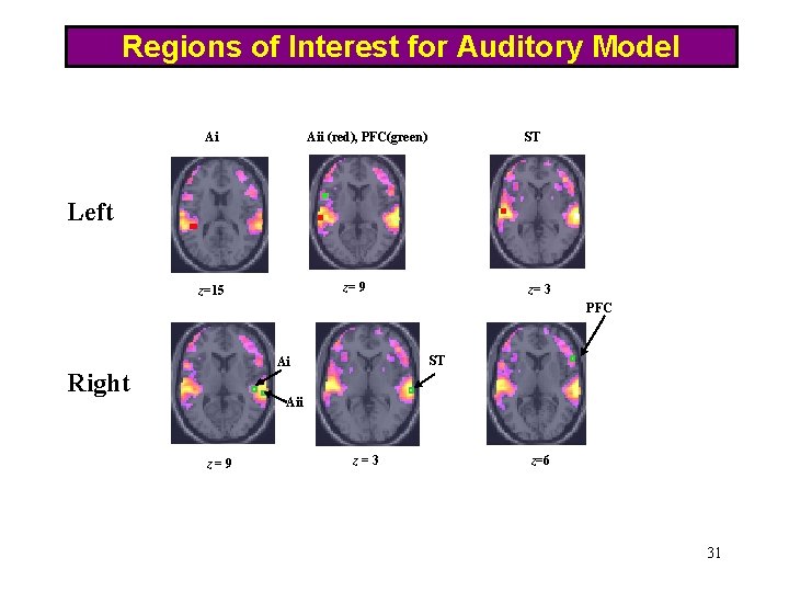 Regions of Interest for Auditory Model Ai Aii (red), PFC(green) ST Left z= 9