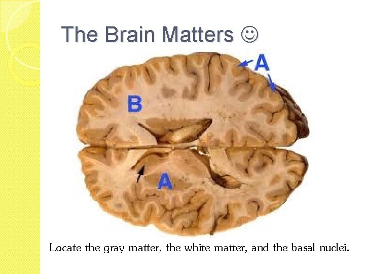 The Brain Matters Locate the gray matter, the white matter, and the basal nuclei.