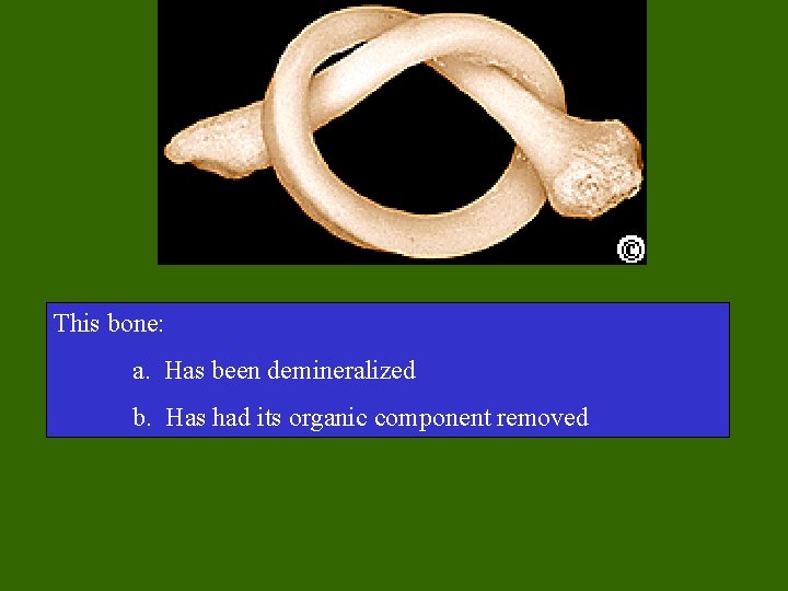 This bone: a. Has been demineralized b. Has had its organic component removed 