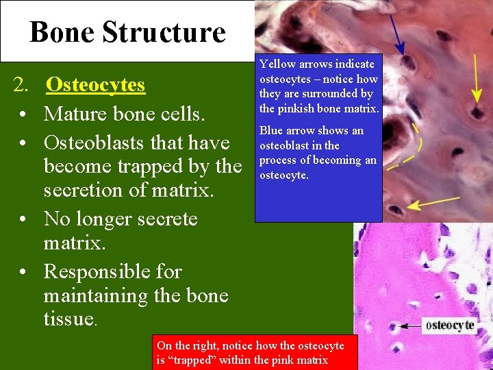 Bone Structure 2. Osteocytes • Mature bone cells. • Osteoblasts that have become trapped