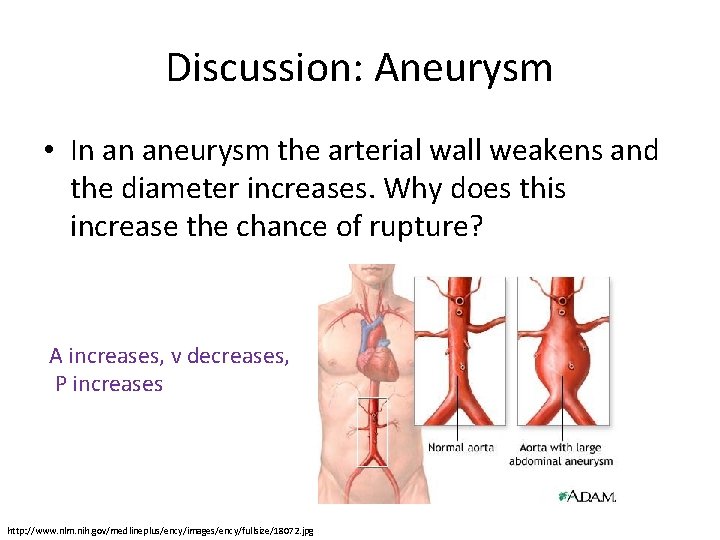 Discussion: Aneurysm • In an aneurysm the arterial wall weakens and the diameter increases.