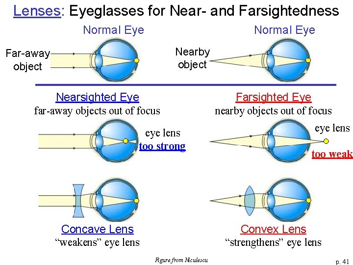Lenses: Eyeglasses for Near- and Farsightedness Normal Eye Nearby object Far-away object Nearsighted Eye
