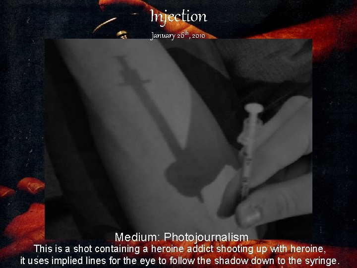 Injection January 26 th, 2010 Medium: Photojournalism This is a shot containing a heroine