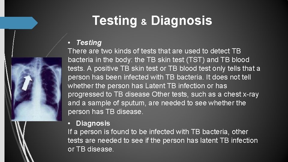 Testing & Diagnosis • Testing There are two kinds of tests that are used Testing & Diagnosis • Testing There are two kinds of tests that are used