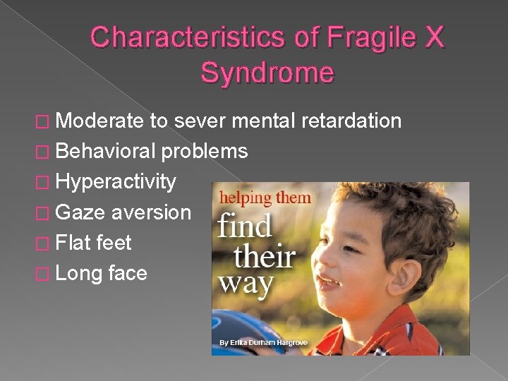 Characteristics of Fragile X Syndrome � Moderate to sever mental retardation � Behavioral problems