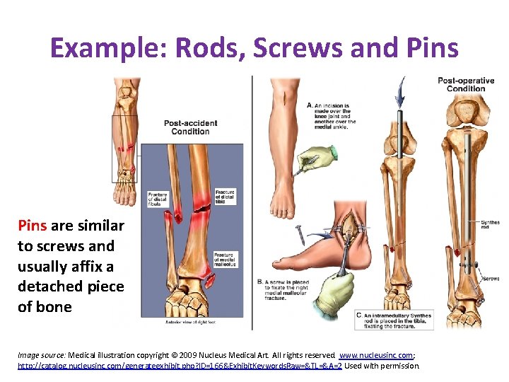Example: Rods, Screws and Pins are similar to screws and usually affix a detached