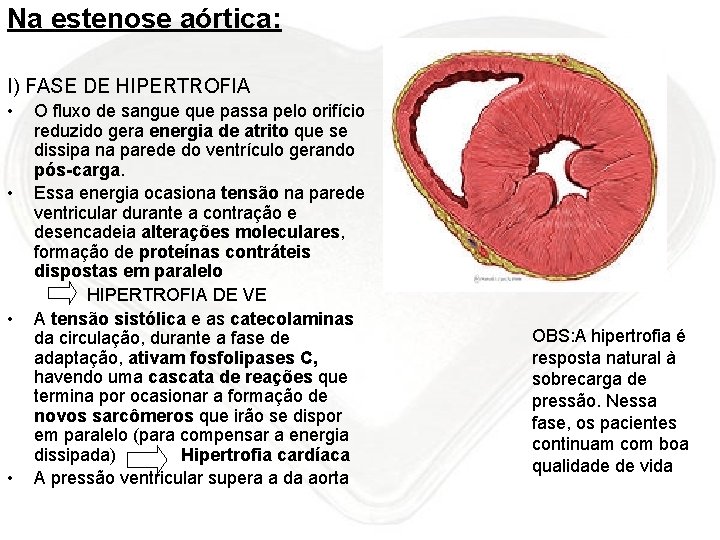 Na estenose aórtica: I) FASE DE HIPERTROFIA • • O fluxo de sangue que