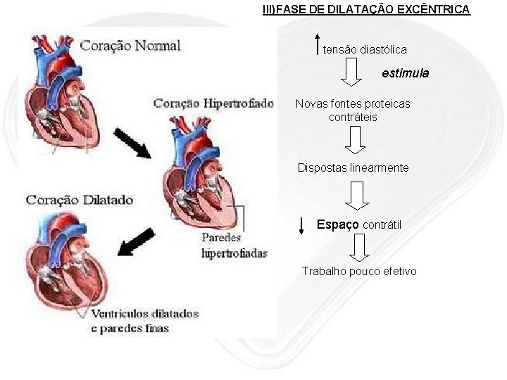 III)FASE DE DILATAÇÃO EXCÊNTRICA tensão diastólica estimula Novas fontes proteicas contráteis Dispostas linearmente Espaço