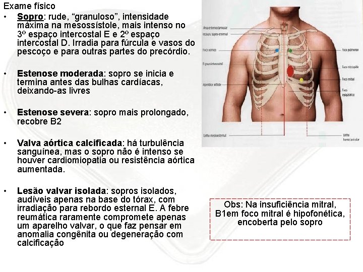 Exame físico • Sopro: rude, “granuloso”, intensidade máxima na mesossístole, mais intenso no 3º