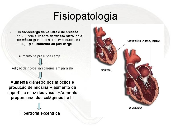 Fisiopatologia • Há sobrecarga de volume e de pressão no VE, com aumento da