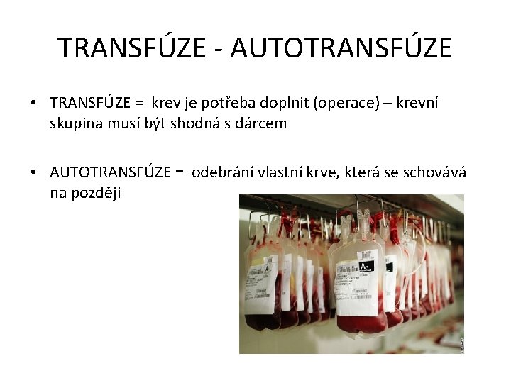 TRANSFÚZE - AUTOTRANSFÚZE • TRANSFÚZE = krev je potřeba doplnit (operace) – krevní skupina