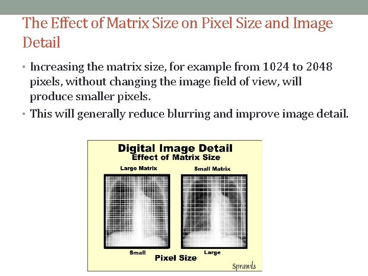 The Effect of Matrix Size on Pixel Size and Image Detail • Increasing the