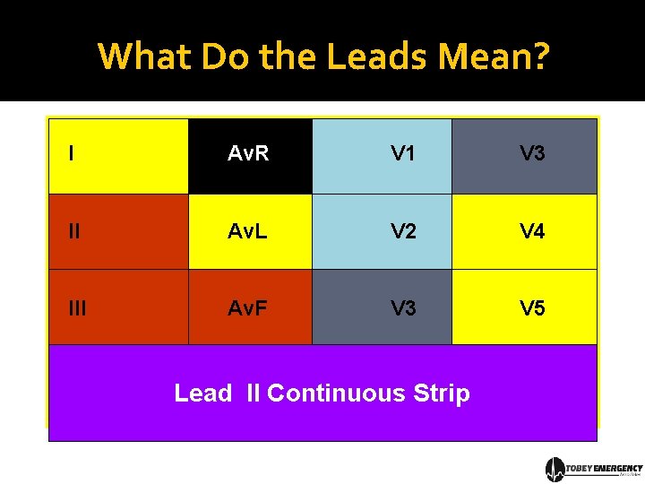What Do the Leads Mean? I Av. R V 1 V 3 II Av.