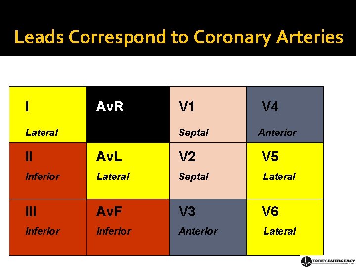 Leads Correspond to Coronary Arteries I Av. R Lateral V 1 Septal V 4
