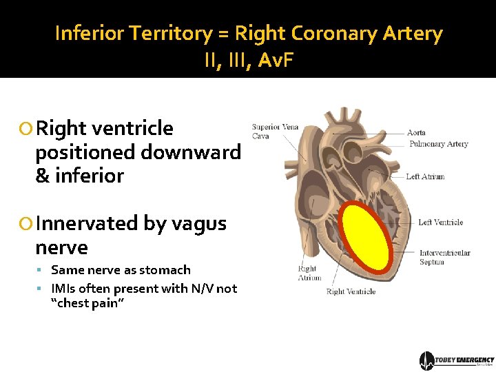 Inferior Territory = Right Coronary Artery II, III, Av. F Right ventricle positioned downward